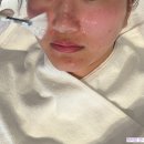 석촌역 피부관리 루아에스테틱 잠실본점에서 모공레이저 받았어요.