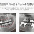 가이드본치과의원 네이버블로그