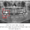 이탑치과 이미지