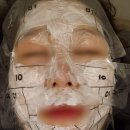 [신촌] 연세리즈의원 주근깨 제거를 위한 IPL 후기(1년전에 시술받고 재시술 받으러 옴) / 위치, 솔직후기