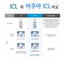 안내렌즈삽입술 (ICL) / 아쿠아 ICL 한눈에 보자 [수술결과 좋은 광주안과] 이미지