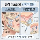 닥터로미성형외과의원 네이버블로그