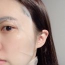 아카필로