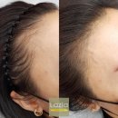 김헤어라인 이미지