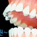 서울윌치과 이미지