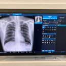 무선하나의원 이미지