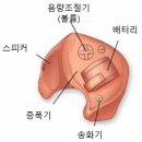 보청기매니저 이미지