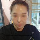 The피부빛나 네이버블로그