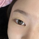 😊 6월 24일 즐거운 토요일 속,무쌍꺼풀눈매 상담후 예쁜눈 보여드려요🫶🏻💙