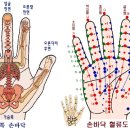 수지침 이미지
