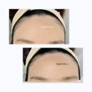 소답동198 | (창원왁싱) 헤어라인왁싱으로 이마에있는 묵은각질과솜털정리까지 하는 일석이조효과👍