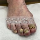 해드림요양원 | 부평 굴포천역 문제성 발톱 봉사활동 후기