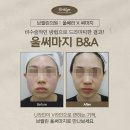 브릴린의원 이미지