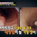 대장암 예방수칙 10가지…우리나라에서 3번째로 흔한 암 막는 방법은? 이미지