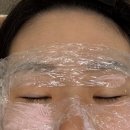 광덕동로 | 출산 후 생긴 주근깨 제거 , 내돈내산 솔직 후기 공개