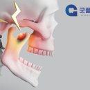 칠곡명인치과의원 | 칠곡3지구 치과, 아침에 턱이 뻐근하고 치아가 시큰하면 '이갈이' 신호일 수 있어요
