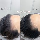 벨레자헤어 - 성북구 | 파주헤어라인 운정헤어라인 잘하는곳 추천 벨레자 !
