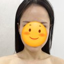광주 윤곽리프팅관리 &lt;더뷰티스토리&gt;