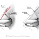에이치에스의원 이미지