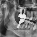 오르세치과의원 이미지