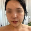 이현선의 소통테라피 | [이현선의 소통테라피] 성신여대역 피부관리 맛집 윤곽관리 후기 – 얼굴 라인 확 살린 관리!