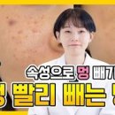 멍드는이유 멍색깔 얼굴 멍 피멍 빨리 빼는법 이미지
