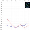 벨톤보청기 이미지