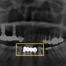 미니쉬치과병원 이미지