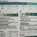 비스타안과의원 | 부산 비스타안과 라섹 검안후기