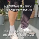 대전광역시청 | 대전광역시청 펜싱 감독님, 다리 통증 후기!