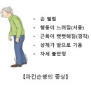 10년전부터 나타나는 파킨슨병의 전조증상 3가지 이미지