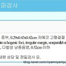 베드로병원 | 30대 갑상선암 진단후기_강남베드로병원, 서울아산병원 외래 후기