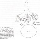 척추관협착증(Spinal stenosis) 이미지