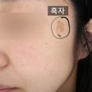 닥터디자이너의원 동탄점 | 동탄, 레이저를 이용한 색소치료 총정리