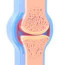 관절천국 이미지