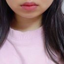 아우라럭스 이미지