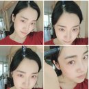 두피열 내리는법-두스틱으로 슥슥 바르면 두피열 직방