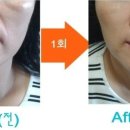 예인피부관리 이미지