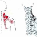 견갑거근 (Levator scapulae) 이미지