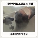 에바니아힐링케어(에제르) | 에벤에제르스캘프 신천점 무료주차, 시흥 트러블 두피관리 리얼후기
