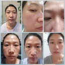 모해인셀덤