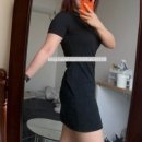 칼로달 | 종로 피부과 명동 바디 지방분해주사 칼로핏주사 내돈내산 후기