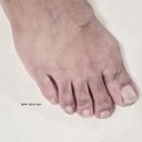 문제성발톱 관리 시작 닥터글로우 손발톱영양제 후기