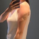 ㈜분당제일에너지 | 분당 피부과 팔뚝 지방분해주사 후기 효과 통증