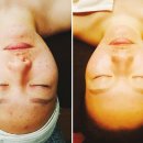 태후바디케어 이미지