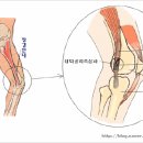 장경인대염 이미지