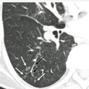 RR-22[화양로]-상-36 | Today's KMLE &amp; ACM 정리 - 1