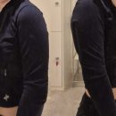 상남동171 | 창원상남동피부과 팔뚝 지방분해 <바디핏 주사> 5일차 후기 통증, 주기, 주의사항