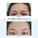 진황도로 | 천호왁싱 뮤코룸뷰티 후기, 깔끔해지고 또렷해진 이유