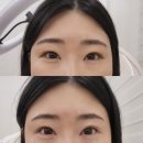 [신림역 속눈썹펌] 꼼꼼 영양케어 리현드림
